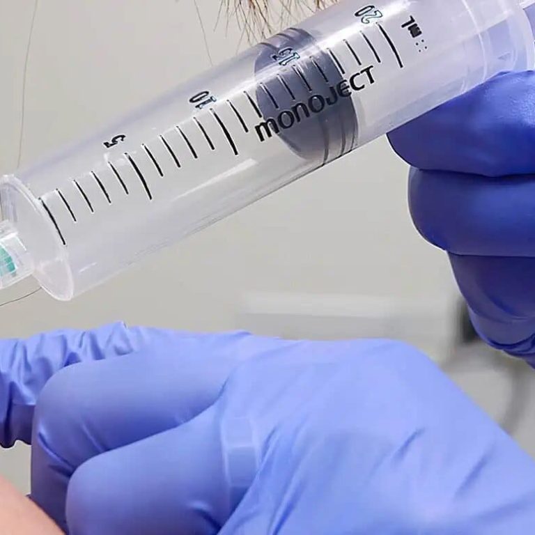 Ozone Injection In Females Shoulder